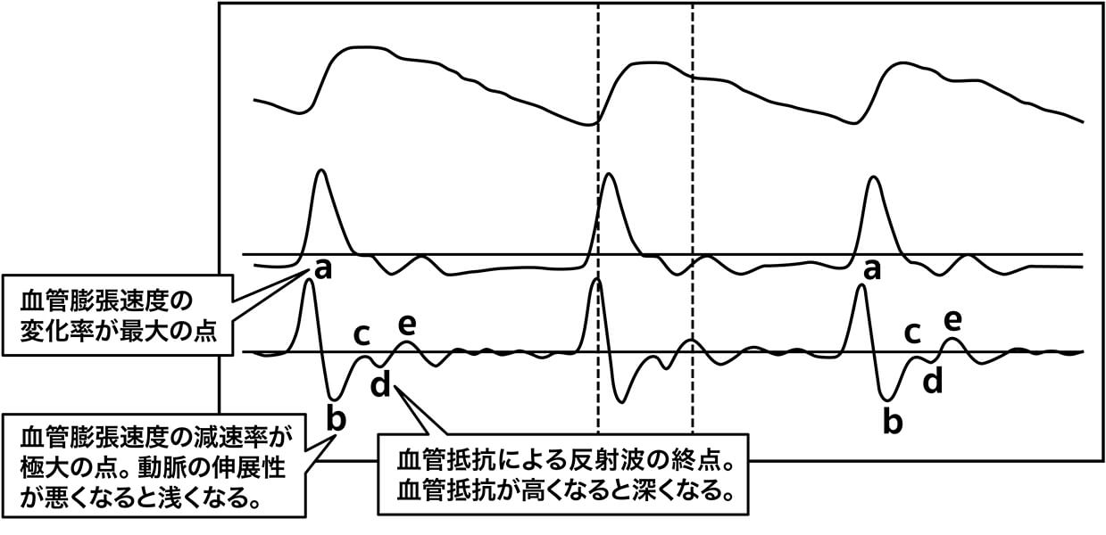 血管膨張速度の変化率が最大の点,血管膨張速度の減速率が極大の点。動脈の伸展性が悪くなると浅くなる。,血管抵抗による反射波の終点。血管抵抗が高くなると深くなる。